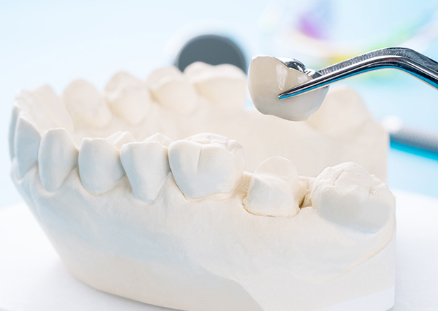 歯の土台の重要性